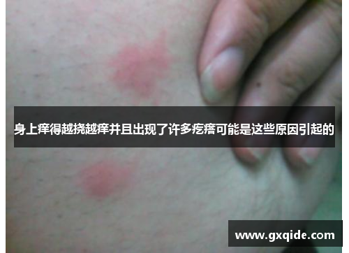 身上痒得越挠越痒并且出现了许多疙瘩可能是这些原因引起的